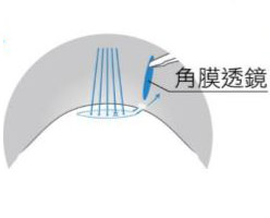 澄欣眼科診所