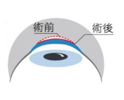 澄欣眼科診所