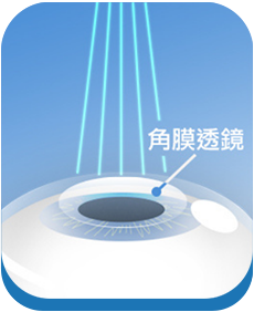 澄欣眼科診所