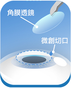 澄欣眼科診所
